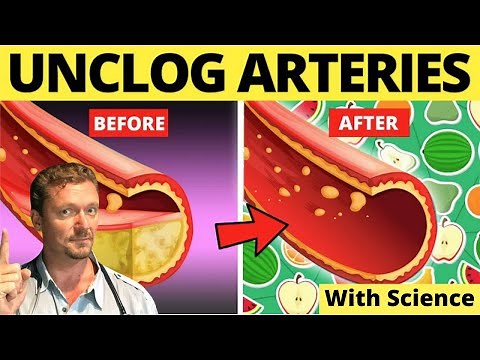 Top Foods to Clean Arteries & Prevent Heart Attack! (Sarcasm Alert!)