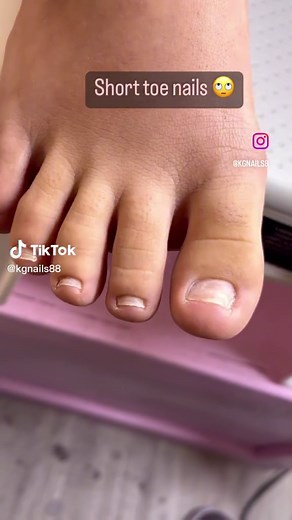 Short Acrylic Toe Nails: French Tip Design Tutorial for Beginners