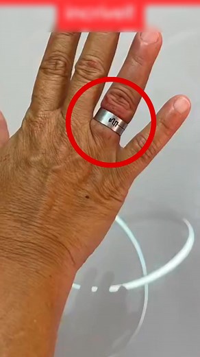 How to remove STUCK ring.#RemoveStuckRing #RingRemoval #DIYTips #RingStuck #RingFix #HandCare #JewelryHacks #RingRescue | Spacefunk