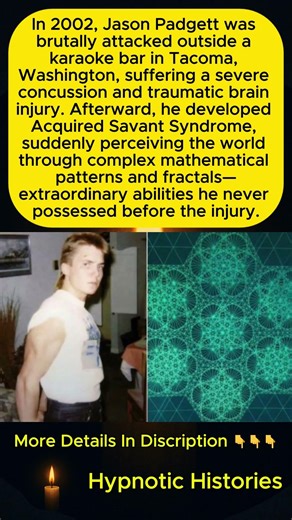 Brutal Attack Unlocked Hidden Genius: The Incredible Case of Acquired Savant Syndrome