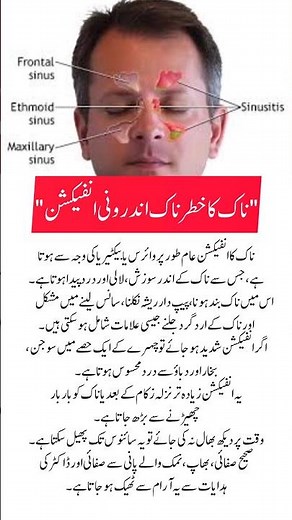 “Understanding Nose Infection: Simple Causes & Easy Relief Tips”(Exactly 5 words not needed in titl