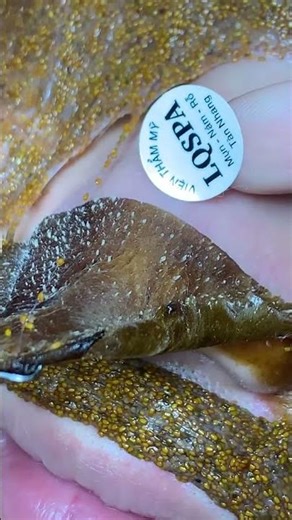 Deep Blackhead 😱 Whitehead Cleaning🫣 | Acne Removal at Home 🏠