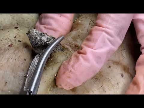 Boogerswax removal | Booger clean | Giant | Pimple popping Longest-Lasting Squeezes 0110m3 0632