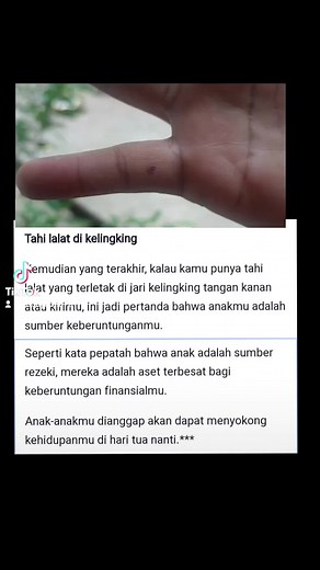 Meaning of Mole on Left Pinky Finger: Symbolism and Interpretation