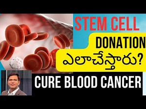 Stem Cell Donation Process: Stem Cell (Bone Marrow)Transplant For Blood Cancer | US Hematologist