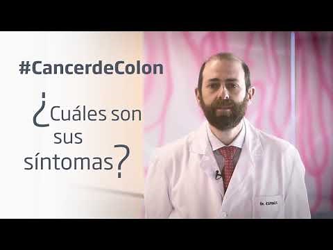 Síntomas del Cáncer de Colon: Reconoce las señales y actúa a tiempo. Clínica Universidad de Navarra
