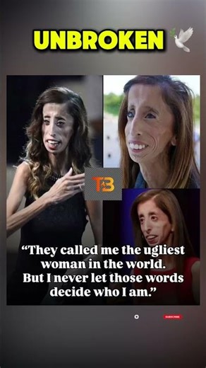 How Lizzie Velásquez Turned "World’s Ugliest" Into World’s Most Inspiring! 🕊️✨ #shortsfeed