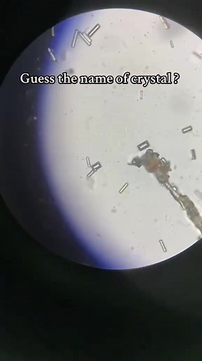 15K views · 187 reactions | Urine sample  #lablife #microbiology | Lab life | Facebook