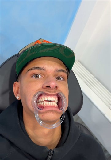 Professionelle Zahnaufhellung in Köln – Bis zu 50% Rabatt!