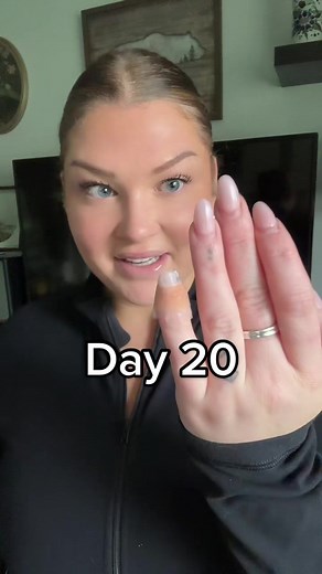 Day 20 ✅