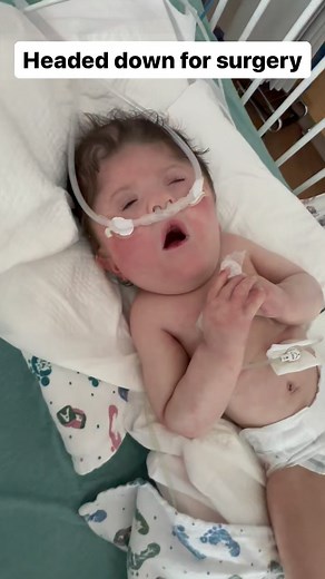 12K views · 1.1K reactions | Little nap before getting the J tube put in. Should be 30 min said the doctors. Well wishes and prayers are being accepted! God bless, we’ll keep ya updated. #update #ares #hairbear #jtube #trisomyawareness #surgerylife #prayersup #prayersneeded #wellwishes #warriorbaby #anglebaby | Hector Hernandez | Facebook