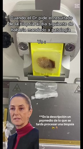 Proceso Detallado de una Biopsia: Tiempo y Pasos Clave