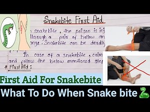 Snakebite First Aid Tips | What To Do When Snake Bite |First Aid Management Of Snake Bite|Snake Bite