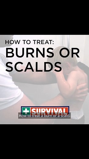 🔥 Don't let a burn ruin your day! Knowing first aid could make all the difference. 🚑Burns can occur due to various factors, but some of the leading causes include:💦 Scalds: Hot liquids, such as water, tea, or cooking oils, particularly among young children and in kitchen accidents.🔥 Fire-related incidents: Accidental fires in homes, workplaces, or bushfires☀️ Sun exposure: Australia's high levels of ultraviolet (UV) radiation make sunburn a significant concern⚡️ Electrical burns: Contact wit