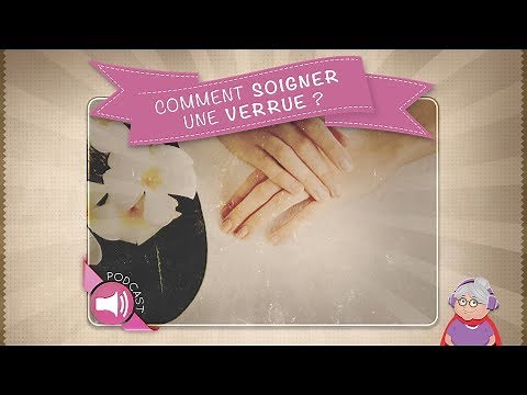 Comment soigner une verrue ?