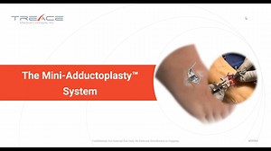 Mastery Webinar - Live Mini-Adductoplasty Demo with SpeedPlate