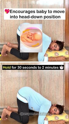 Breech Baby ? Try this gentle and Effective Technique !!!