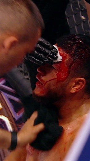 You don't see that every day! #octagon #mma #fighting