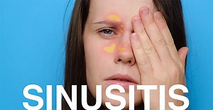 Sinus transillumination | Nasodren