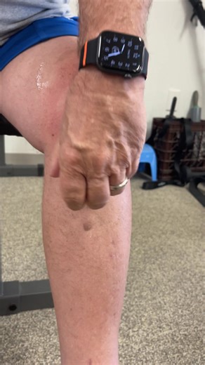 That’s what one of my patients told me just a few weeks after her total knee replacement. . She was frustrated. The swelling, the stiffness, the tight band feeling across her scar—it all made bending the knee feel impossible. . And like so many recovering from surgery, she was doing everything right: physical therapy, home exercises, ice, elevation… yet progress felt painfully slow. . That’s when I introduced her to something simple but incredibly effective: at-home cupping therapy. . 💡 Why Cup