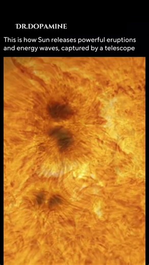 Let the sun burn 😮‍💨 #fact #relatable #shorts