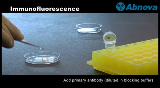 Immunofluorescence 免疫荧光