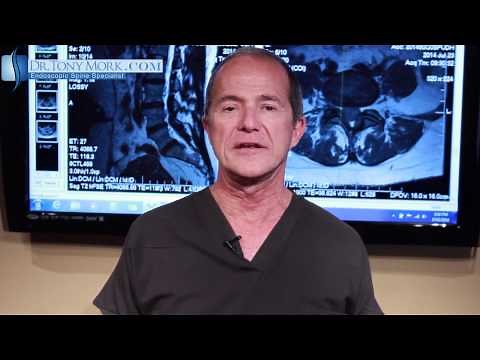 TENS Unit for Chronic Low Back Pain