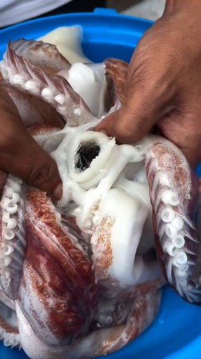 Health / Fitness / Beauty on Instagram: "ऑपरेशन से डरते हो? 😨 पथरी के लिए ये देसी उपाय जान लो! ------ #PathriKaIlaj #KidneyStone #PathriProblem #DesiNuskha #AyurvedicTips ----- यह जानकारी घरेलू अनुभव और सामान्य ज्ञान पर आधारित है। पथरी बड़ी हो, तेज़ दर्द या इन्फेक्शन हो तो डॉक्टर की सलाह ज़रूरी लें।"