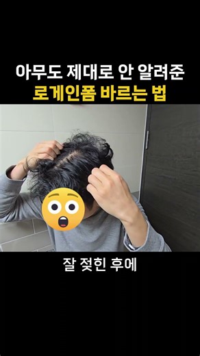 로게인폼 그렇게 바르면 효과 없어요!