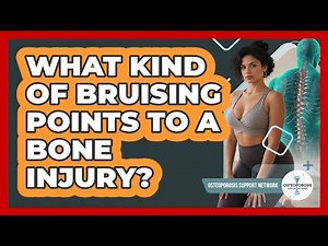 What Kind of Bruising Points to a Bone Injury?