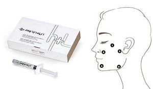 [Hot Item] Face Lift Improve Skin Profhilo H L Anti-Wrinkle Injection Profhilo Injection Hyaluronic Acid Dermal Filler Five Points of Improvement