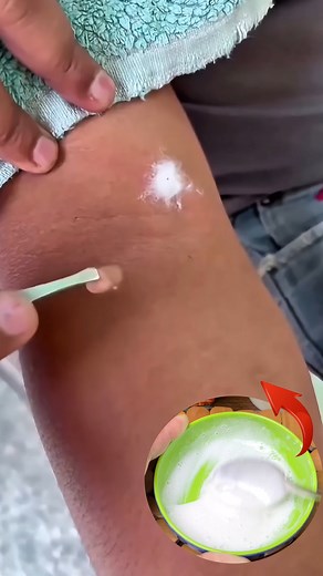 Remove warts permanently with toothpaste #wart #natural #healthtips #reels | Divine Beauty Tips