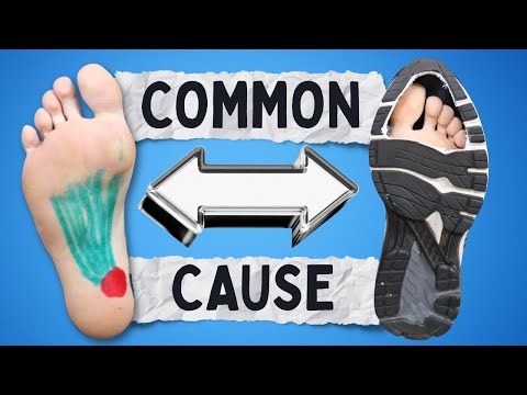 Fix Foot Pain & Plantar Fasciitis (All You Need to Know)