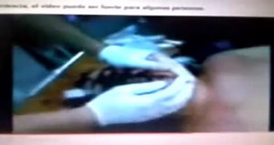 #OMG - Man splits his face in two