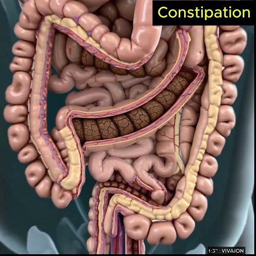 Slow Motion Constipated Stool Exit – Human Anatomy | 130