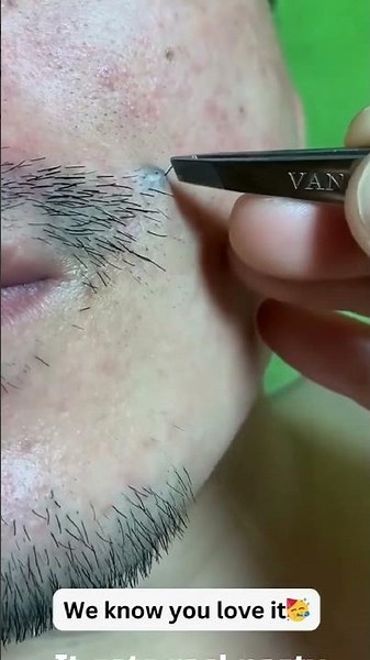 How painful does this look on a scale 𝟏-𝟏𝟎 😵🤯😩💀