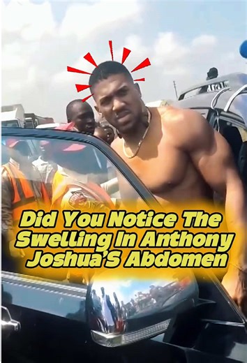Did you notice the swelling in Anthony Joshua’s Abdomen.#celebrity#usa#us#AnthonyJoshua #foryou