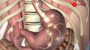 Stomach Disorders Symptoms and Treatment Dr Mashkoor Beig Gastroenterologist Explains Report Yasir Yousuf | Prime Post