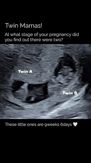 2K views · 11K reactions |  Double the surprise, double the love!...