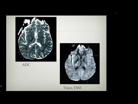 Week 2 review of imaging physics and how to optimize CTA imaging HD 1080p