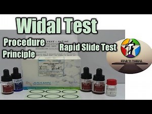 Widal Test Method ll it's principle ll Rapid Slide Test