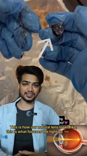 Real Human Eye Inside View | Eye Anatomy You’ve Never Seen ! Real Eye Anatomy Explained. #eyes