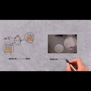 零基础认识皮肤结构，看完整个人皮肤都变好了