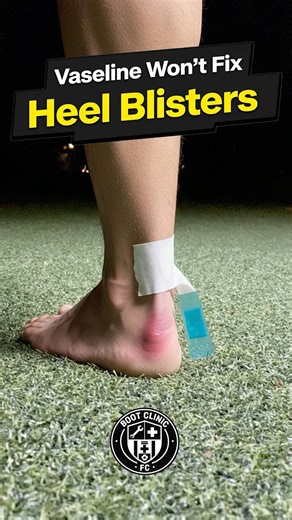 Vaseline Won’t Fix Heel Blisters! #football #soccer