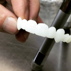 1.4K views · 30 reactions | Vampire Fangs - Dental Veneers for...