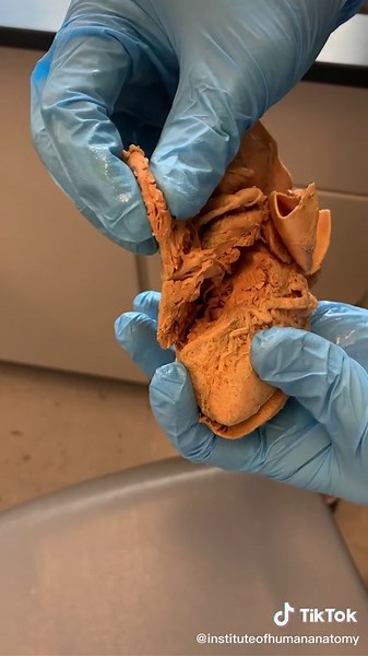 Understanding Ventricle Thickness in Human Heart Anatomy