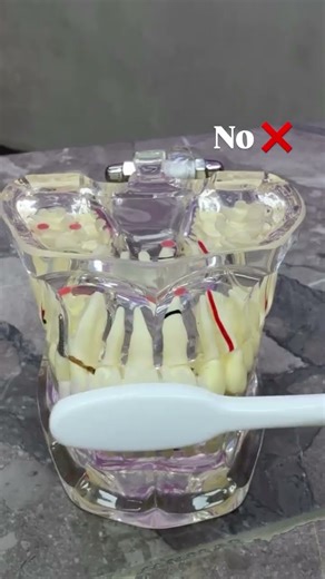 Correct brushing technique explained , ORAL HYGIENE HABITS #SHORTS