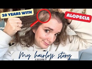 20 Years of Alopecia: Evolution & the Solution That Changed Everything