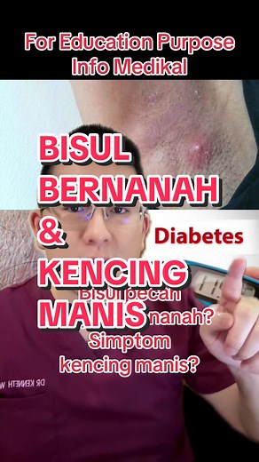 Bisul Bernanah dan Simptom Kencing Manis