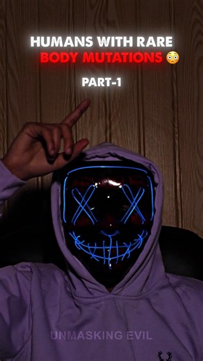 Humans With Rare Body Mutations #shorts